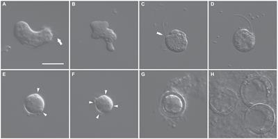 Accumulation patterns of intracellular salts in a new halophilic amoeboflagellate, Euplaesiobystra salpumilio sp. nov., (Heterolobosea; Discoba) under hypersaline conditions